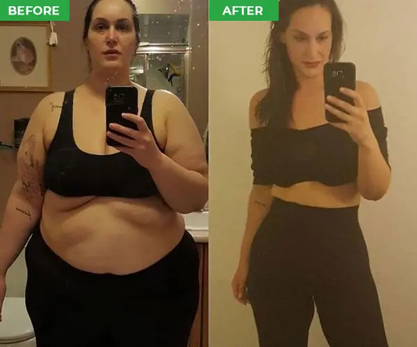 ElectroSlim before and AFter